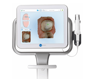 iTero Scanner
