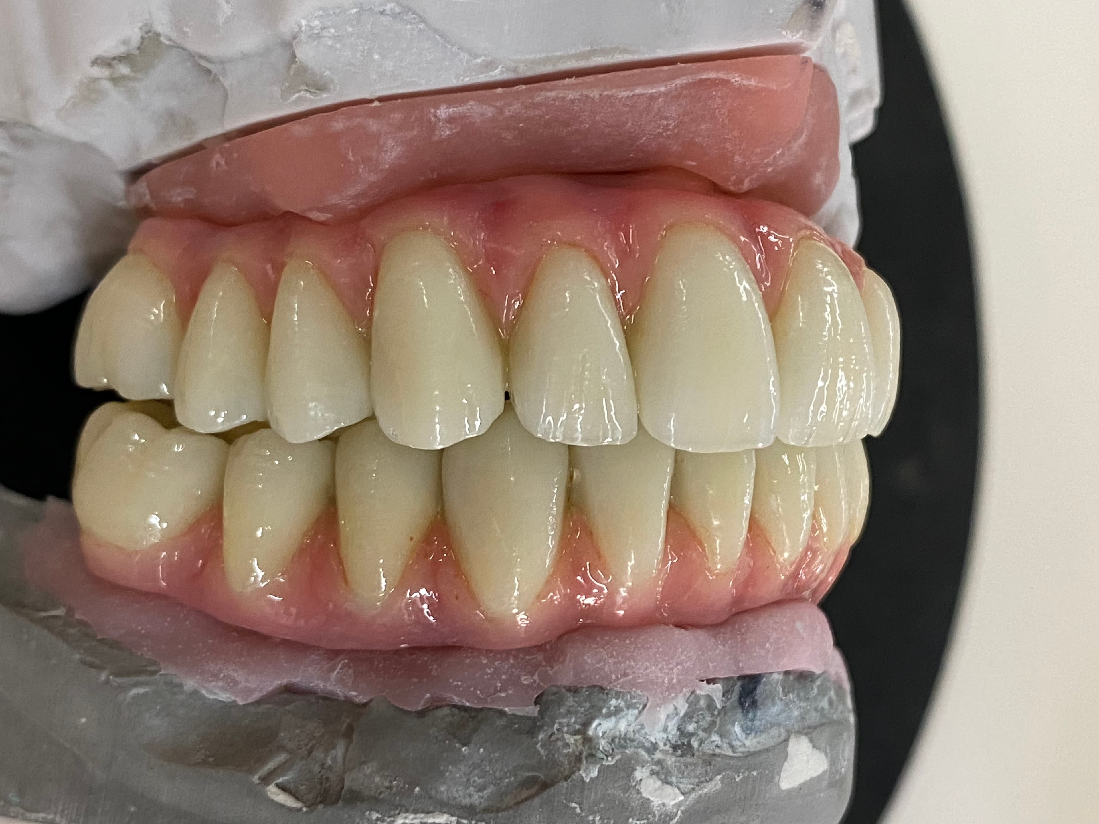 Full Upper & Lower Composite Wraps – image 2