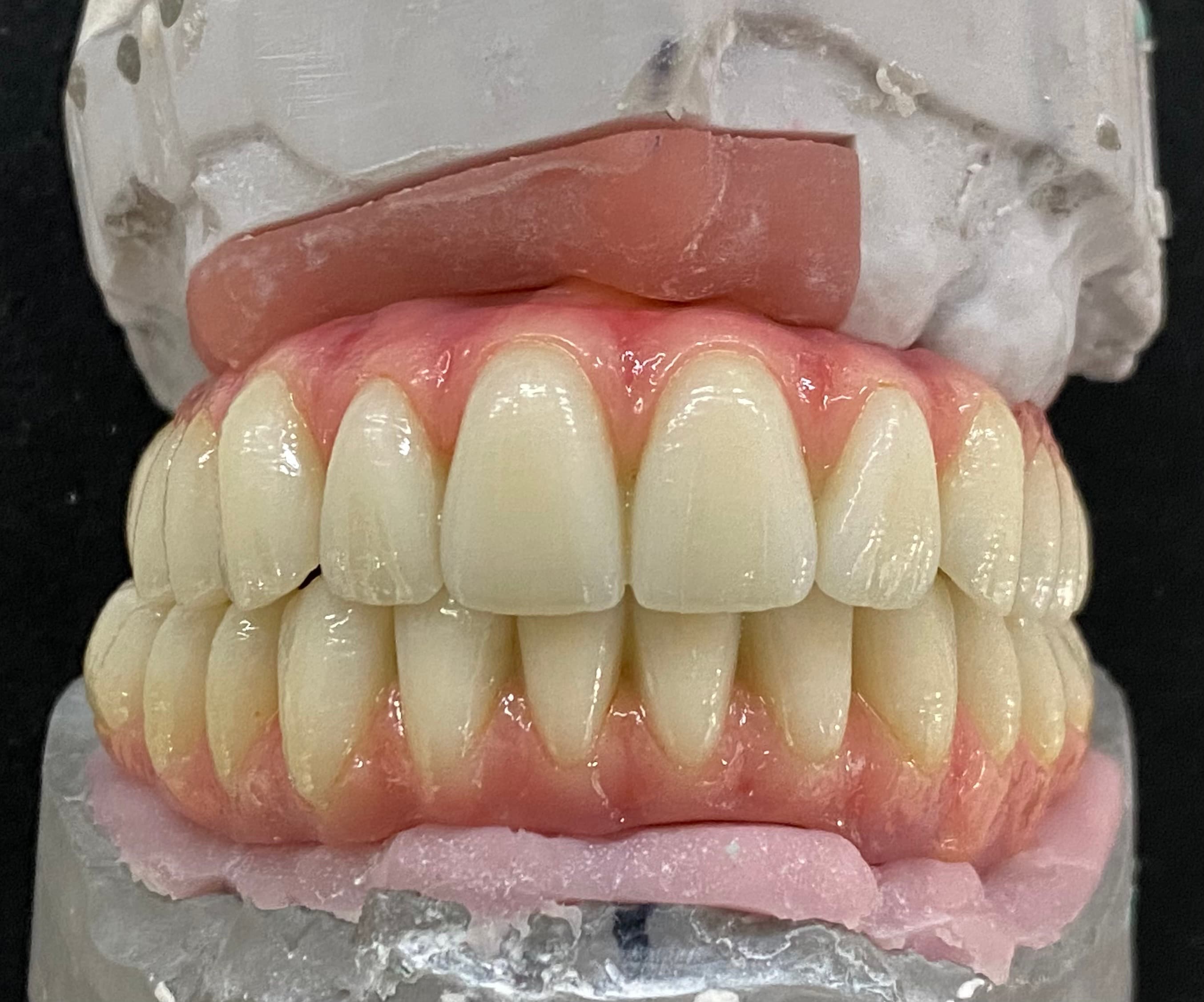 Full Upper & Lower Composite Wraps – image 6