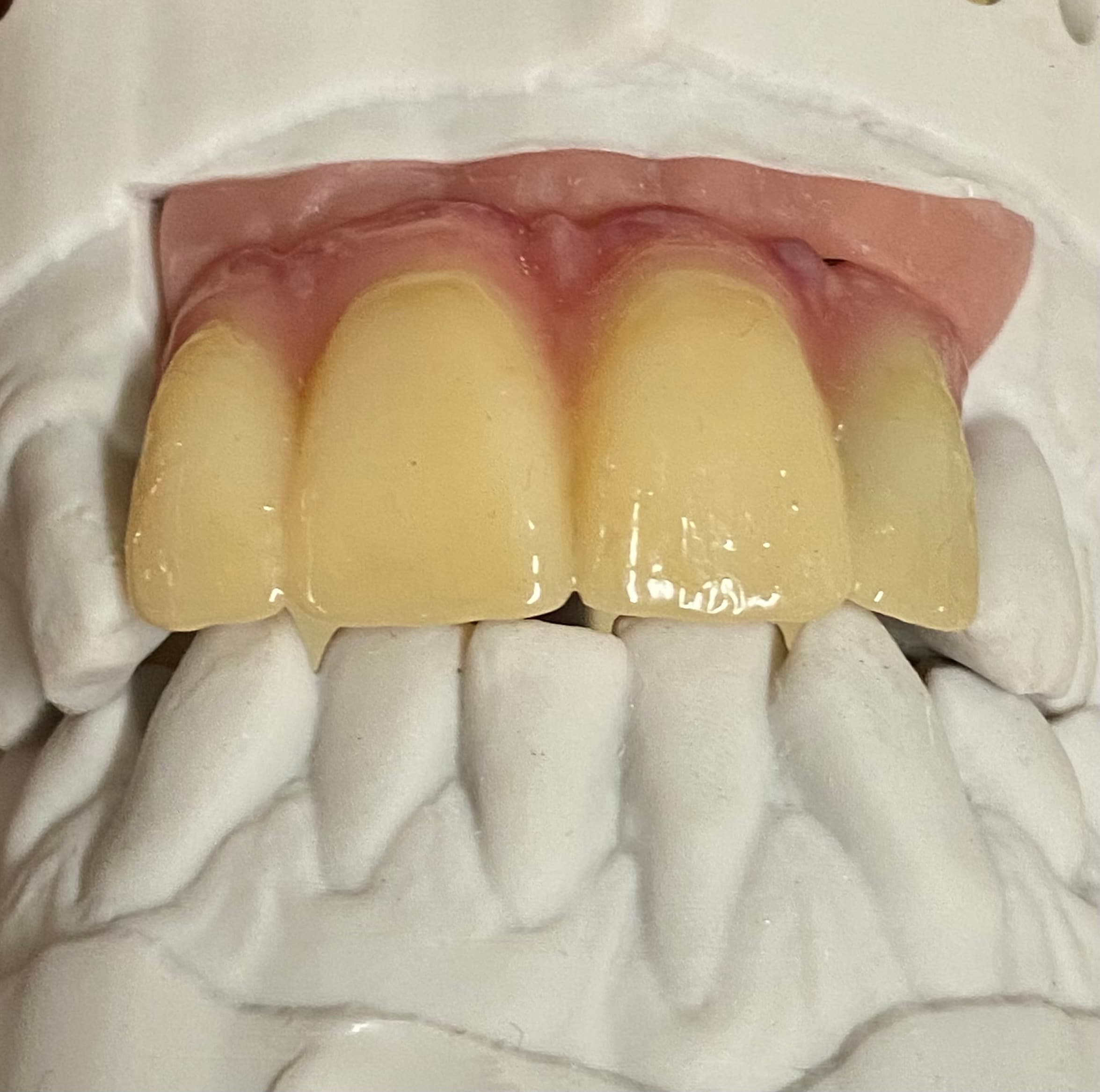 Long-term Provisional Composite – image 2
