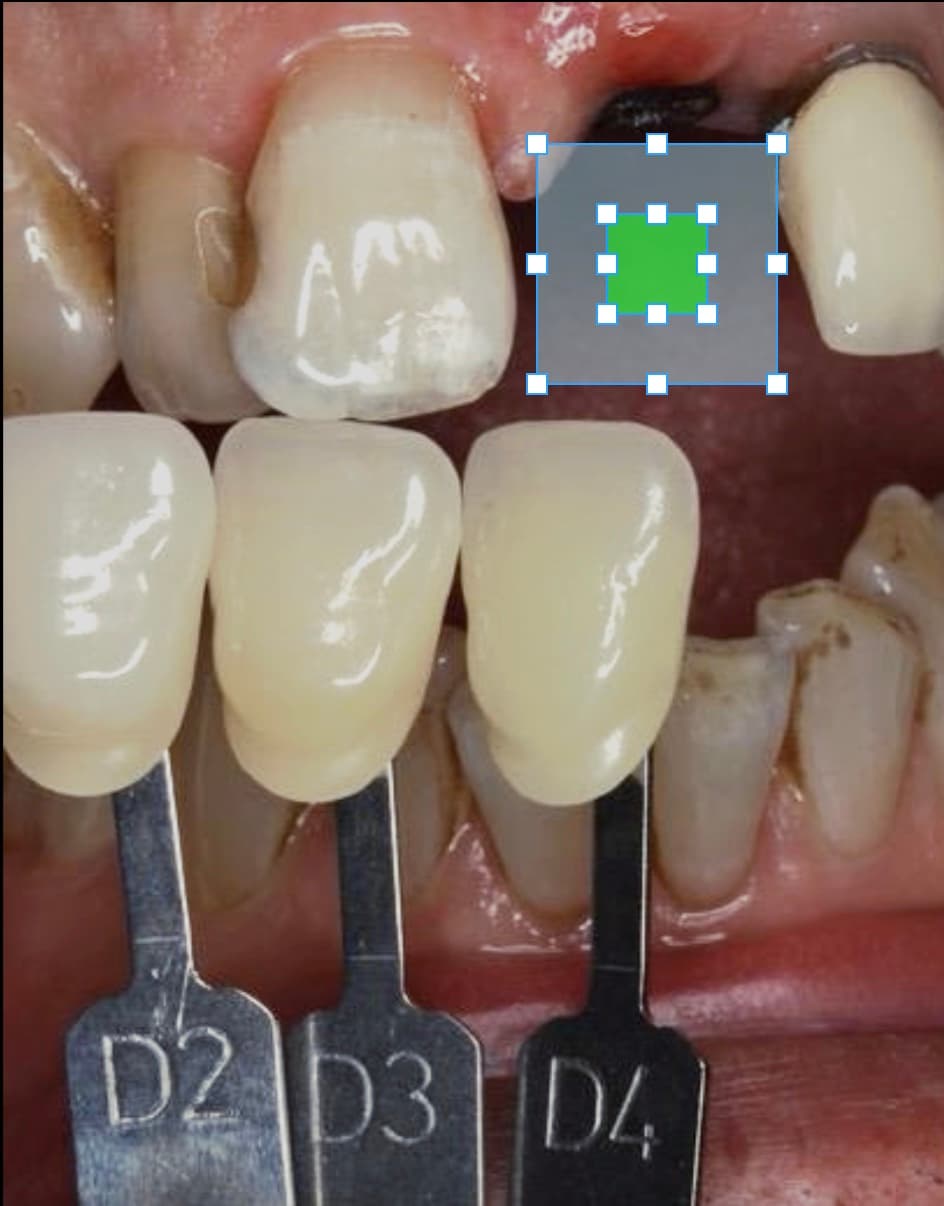 Understanding Shadewave Systems – image 2