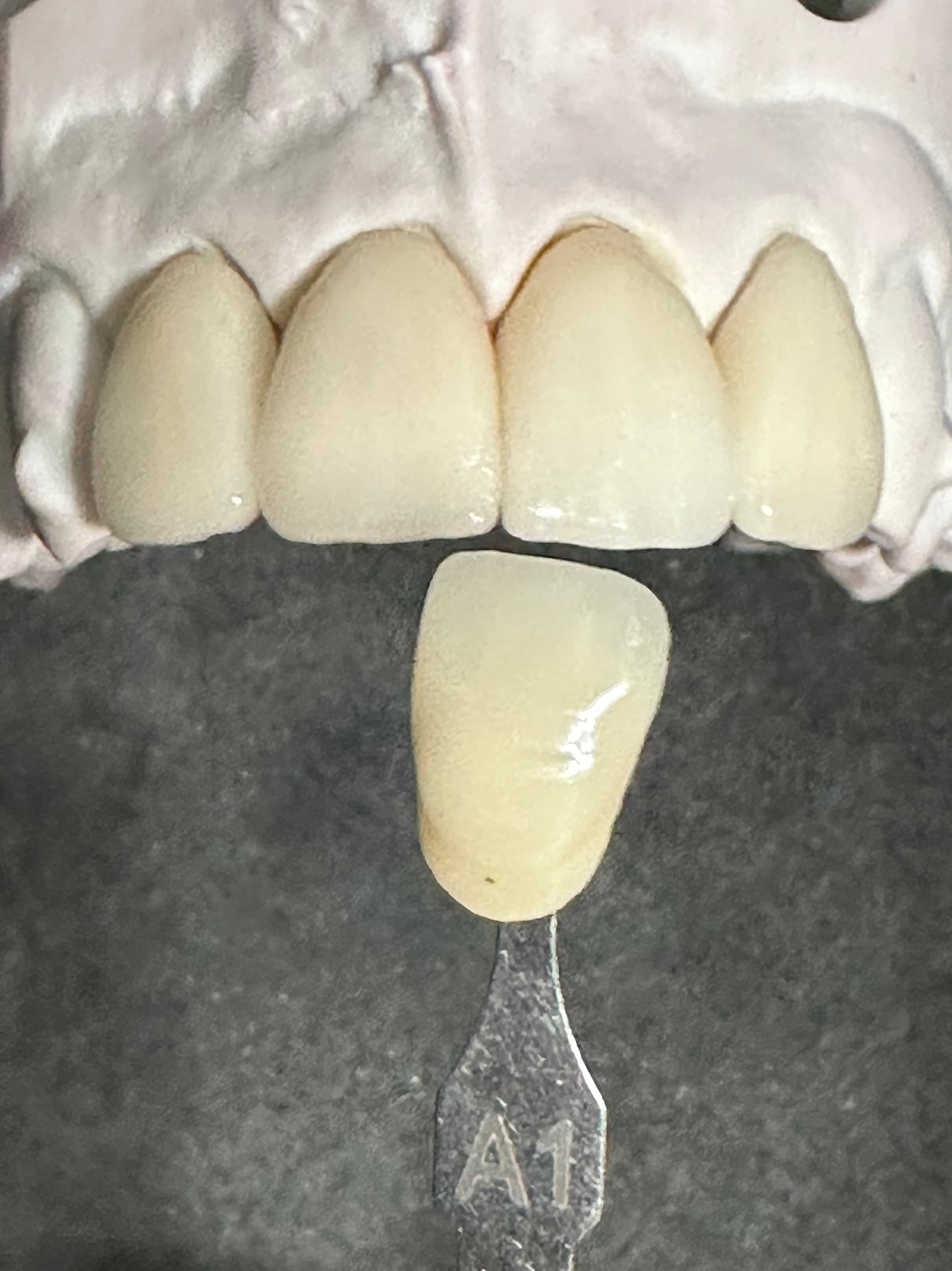 Translucent All Ceramics