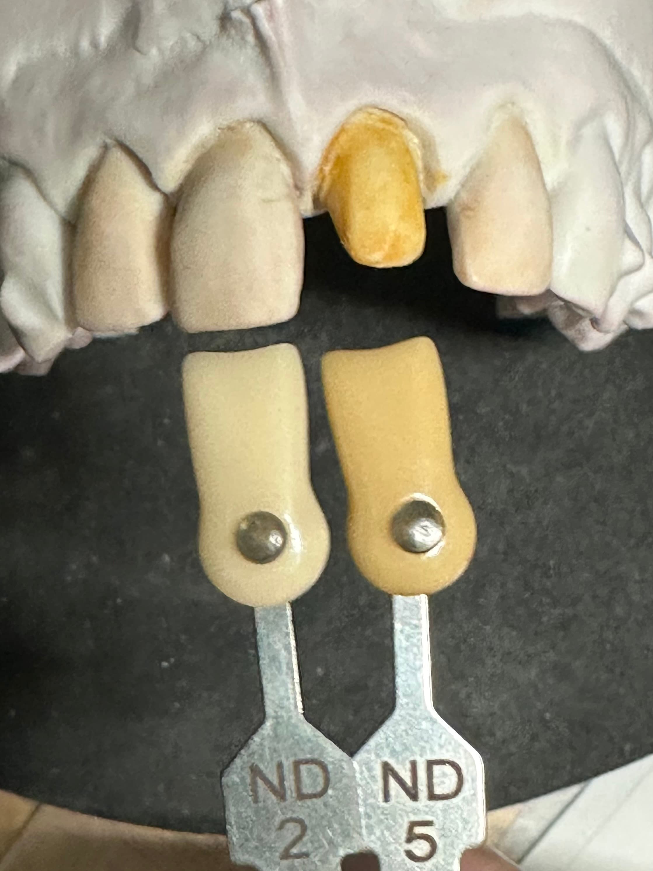 Translucent All Ceramics – image 4