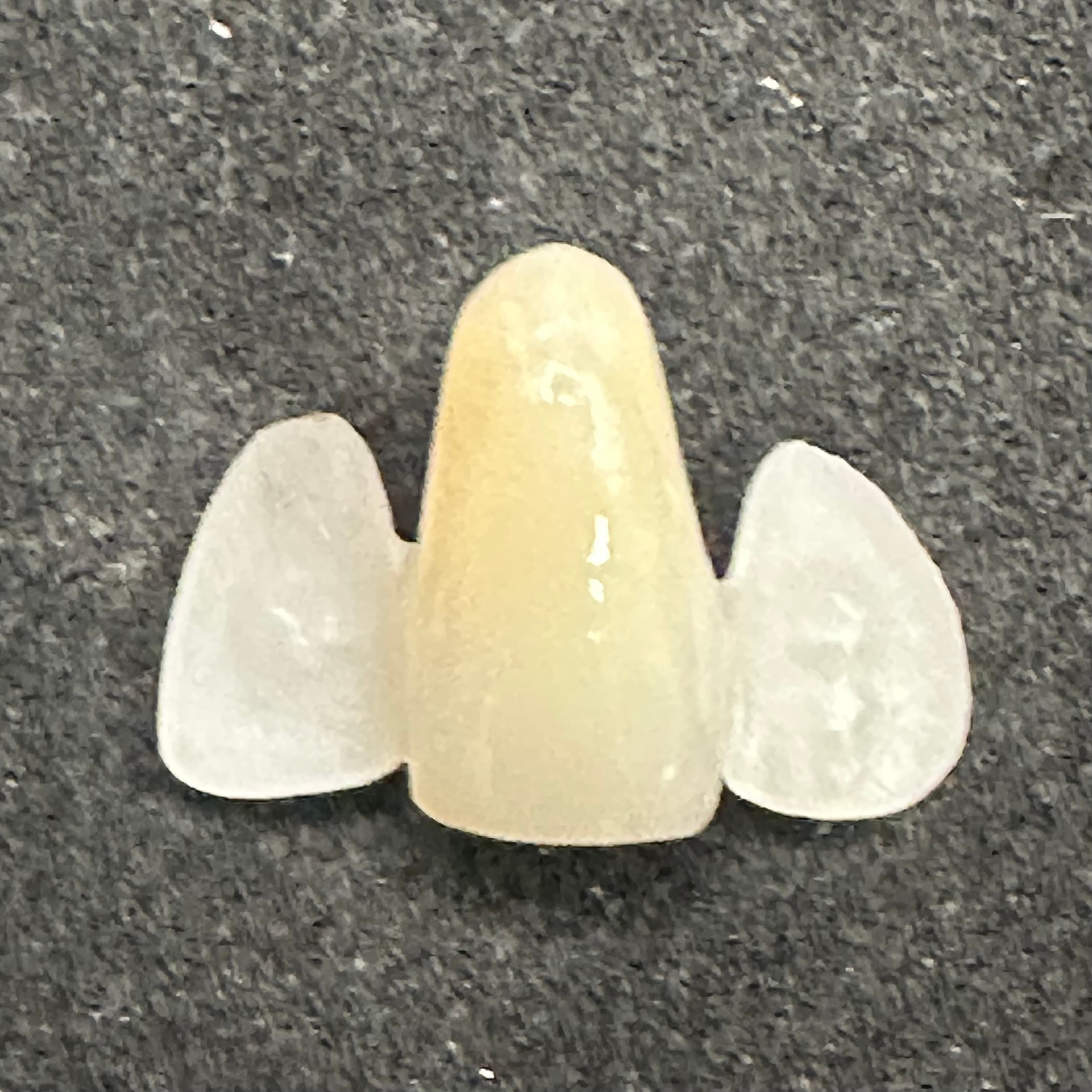 Fusion-Zirconia Maryland Pre-Sinter Etched