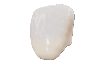 Anterior Crown