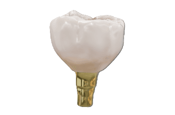 Posterior Crown