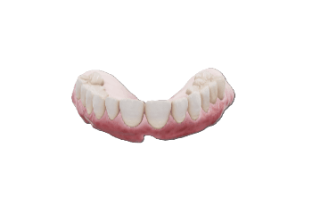 Full Denture