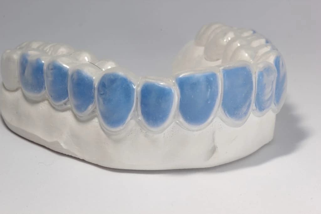 Close‑up showing gingival adaptation 2