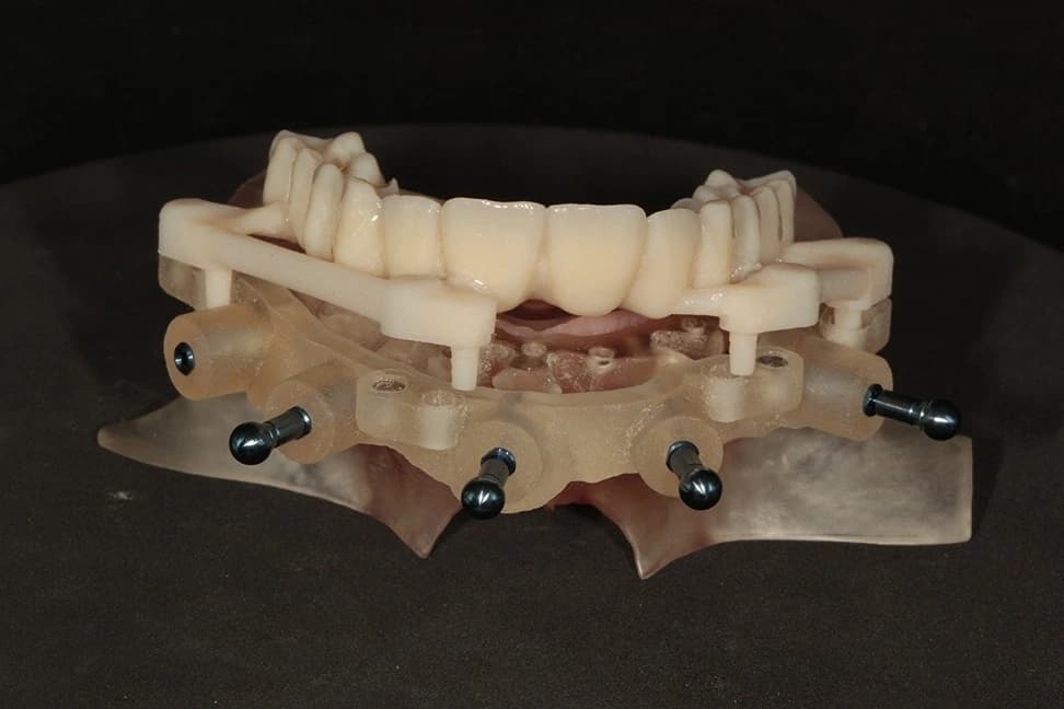 Stage 9: Transitional Bridge Location Pins LOCATED
