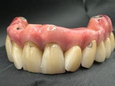 Image: Hybrid implant-supported Ti-bar with monolithic & layered zirconia crowns; titanium milled bar with hand-layered gingival effect composites Images 2 & 3 show component parts