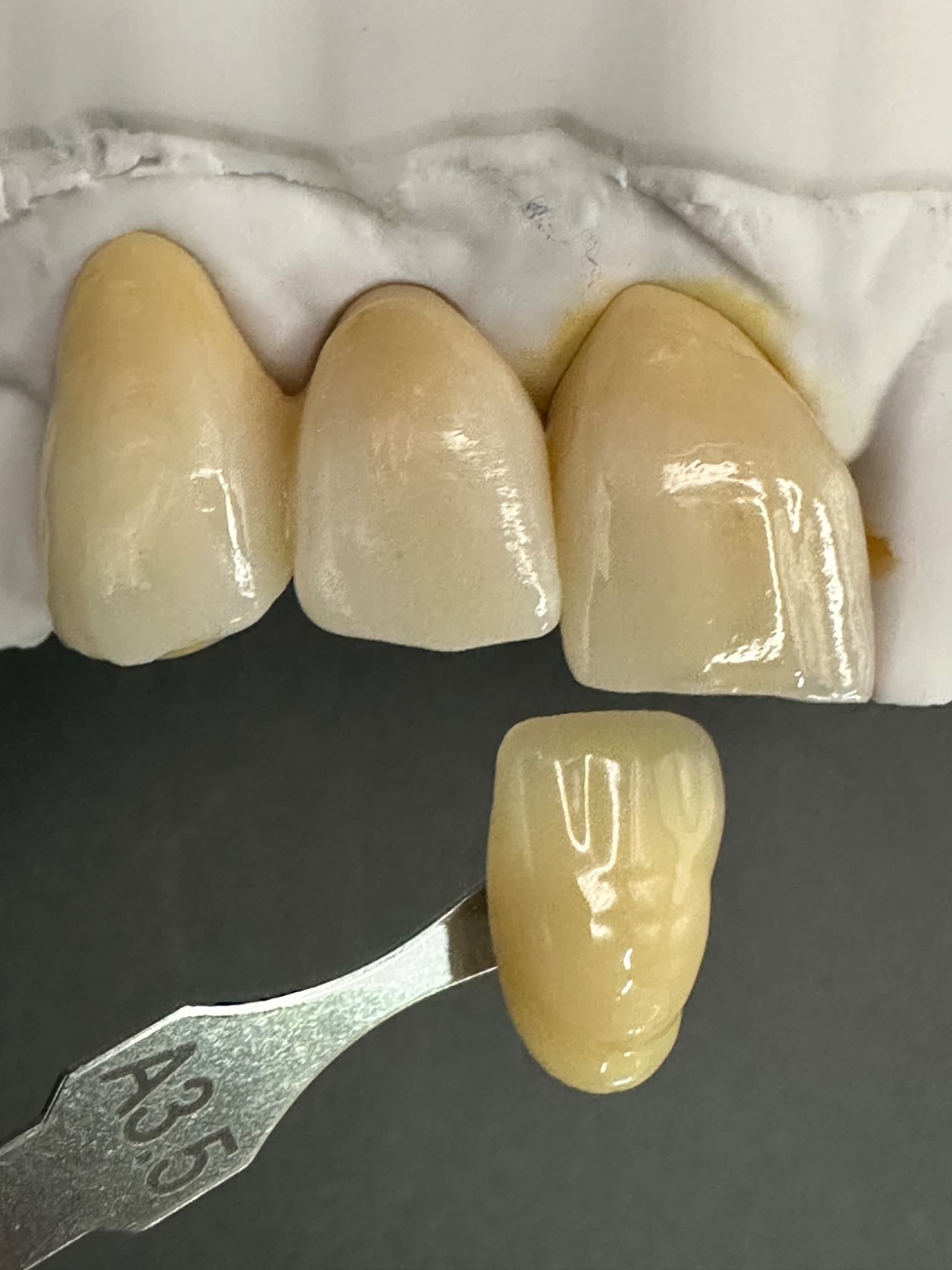 Images: UR2 milled higher in the puck than UR1 for more enamel translucency