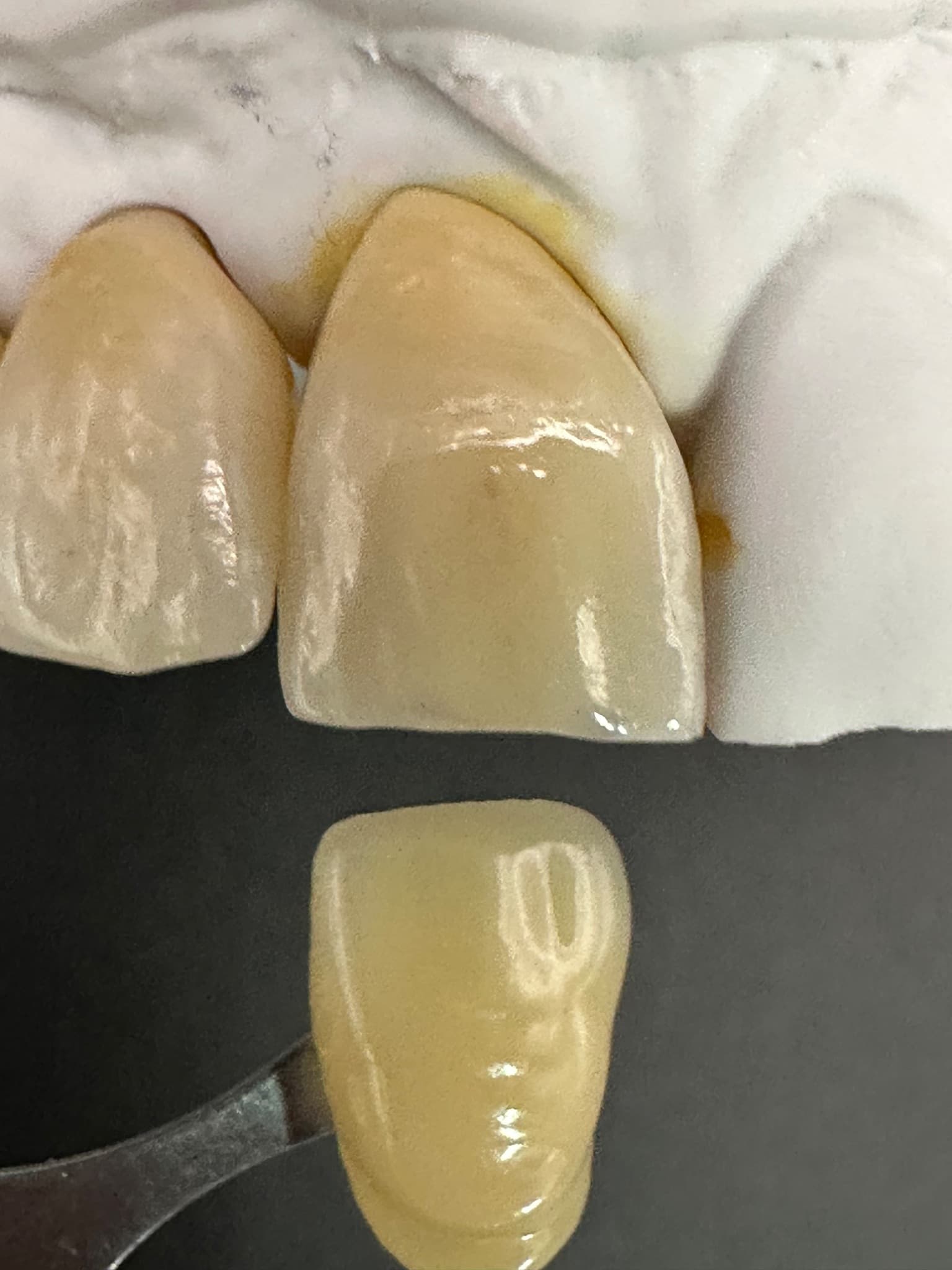 Images: UR2 milled higher in the puck than UR1 for more enamel translucency