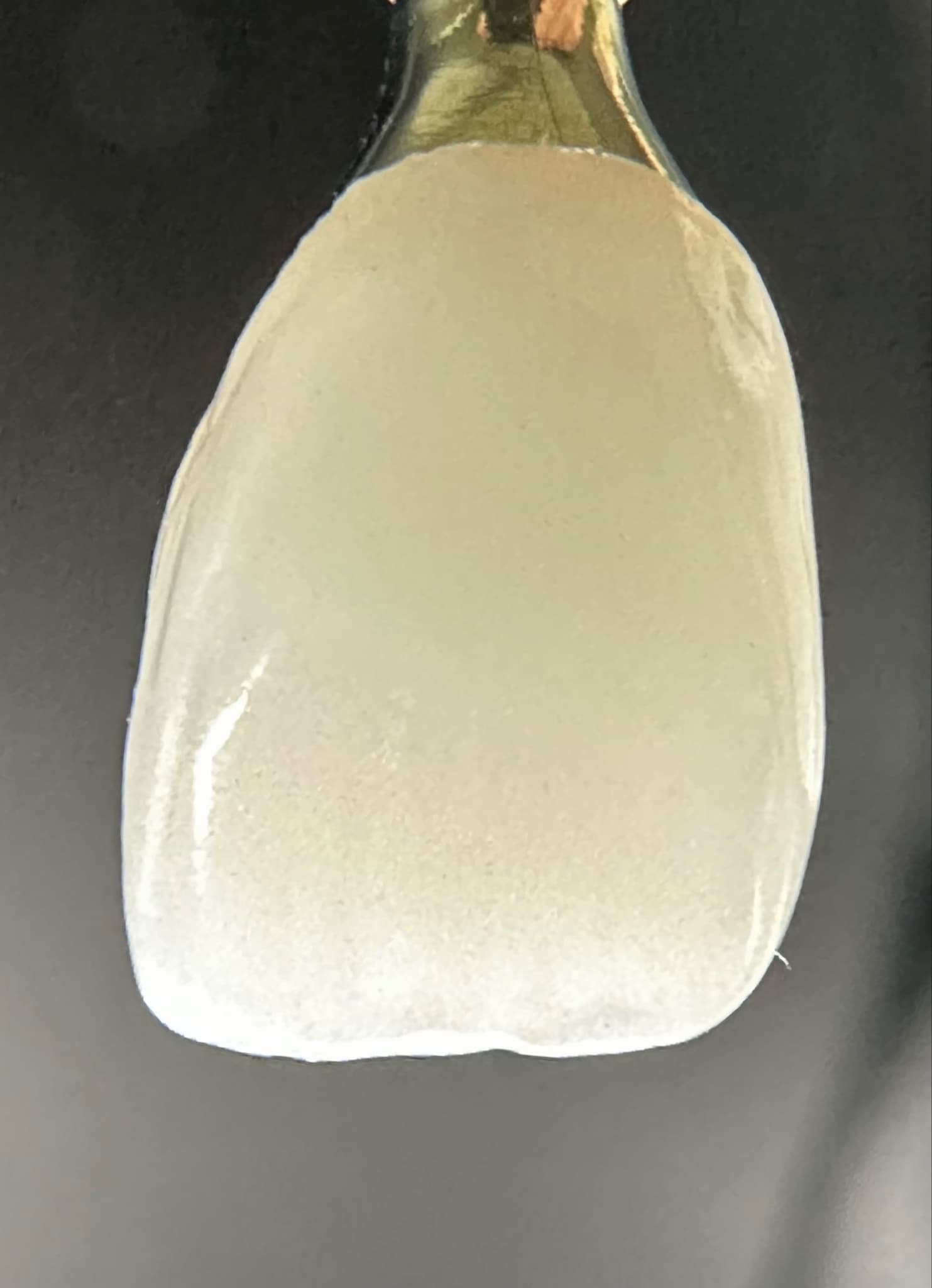Images: 1, 2 & 3 show higher position in-puck-placed UL1 youthful implant crown maximising the translucency zone