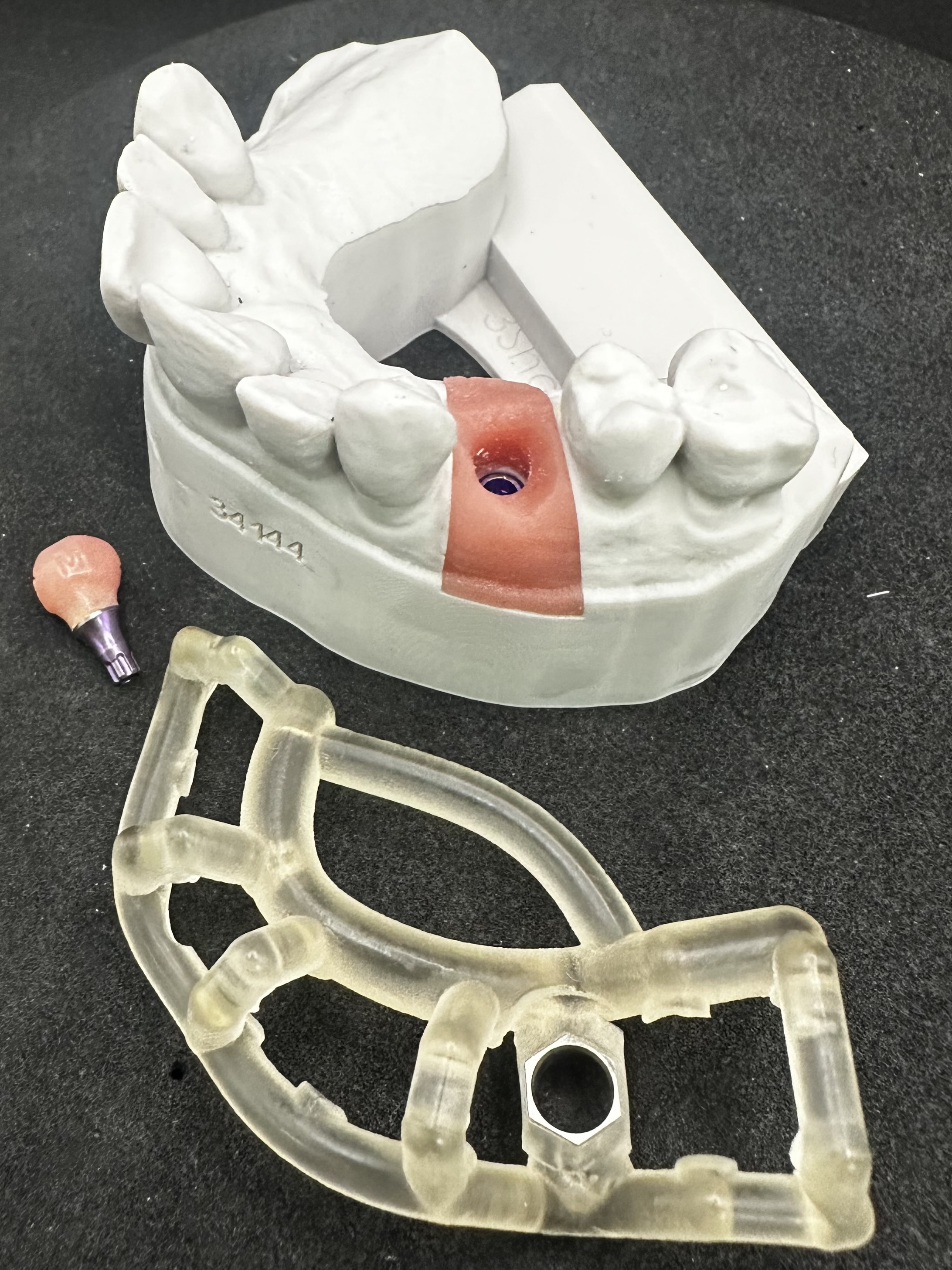 The guide and Custom Healing Abutment ready for surgery.